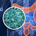 Tìm hiểu bệnh viêm manh tràng và mức độ nguy hiểm của bệnh