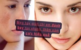 Mẹo hay giúp chị em đánh bay tàn nhang, thâm nám cực hiệu quả